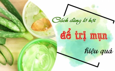 Hết sạch mụn trứng cá với những cách sử dụng lô hội hiệu quả