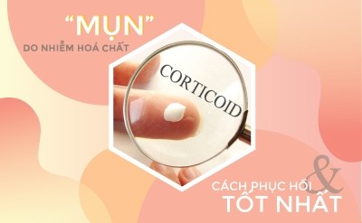 Mụn do nhiễm hóa chất (corticoid) và cách để phục hồi tốt nhất