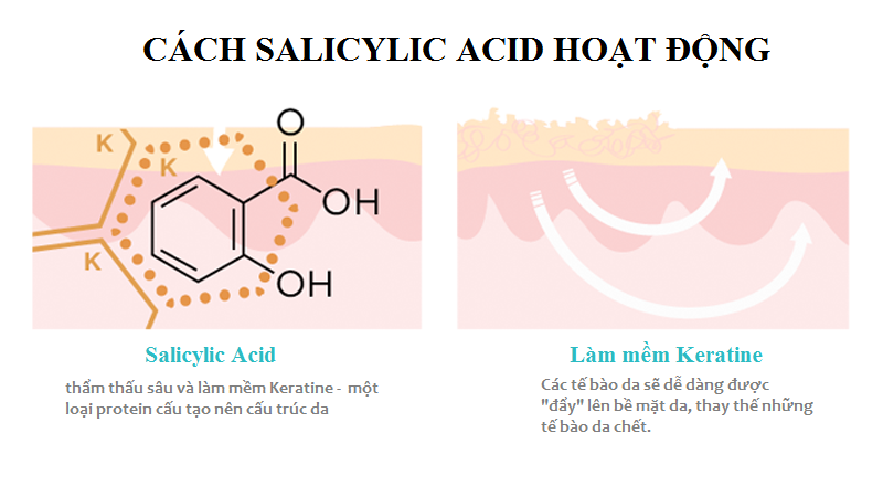 Salicylic Acid giúp làm thông thoáng lỗ chân lông, tiêu diệt vi khuẩn gây mụn