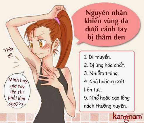 cách trị thâm nách hiệu quả nhanh chóng