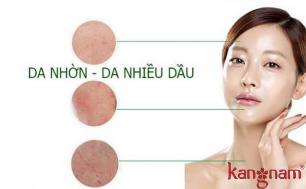 Biểu hiện của da dầu, da nhờn