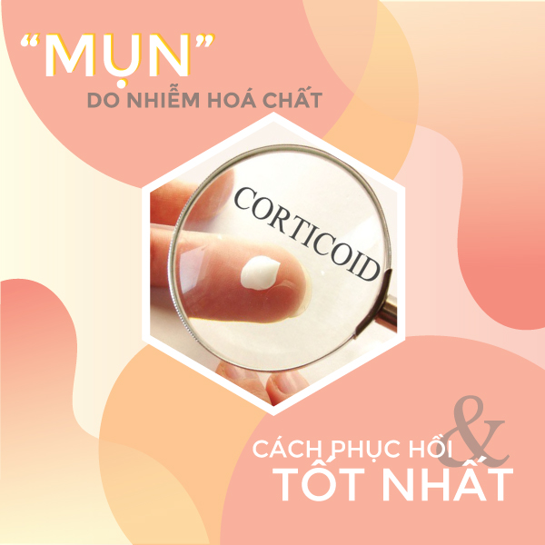 Cách giải quyết mụn do nhiễm hóa chất corticoid