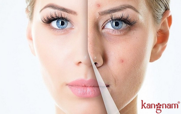 serum giảm nám chống lão hóa da Murad có giá bao nhiêu