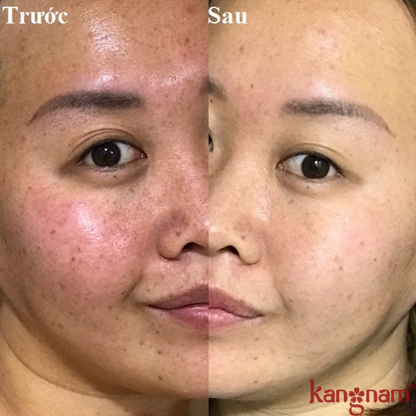 review-serum-giam-nam-ngan-ngua-lao-hoa-murad-6