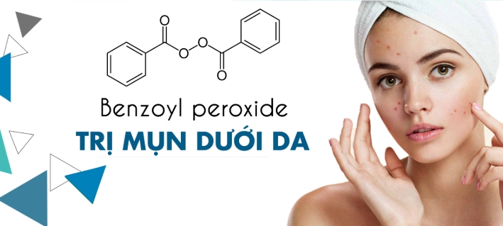 Benzol Peroxide giúp trị mụn